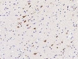 Invitrogen Calbindin Polyclonal Antibody 100 &mu;L; Unconjugated:Antibodies,