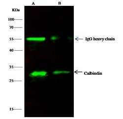 Invitrogen Calbindin Polyclonal Antibody 100 &mu;L; Unconjugated:Antibodies,