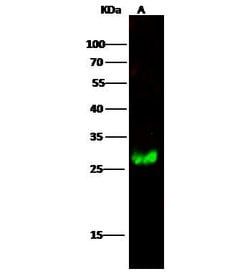 Invitrogen Calbindin Polyclonal Antibody 100 &mu;L; Unconjugated:Antibodies,