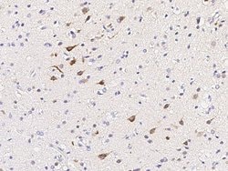 Invitrogen Calbindin Polyclonal Antibody 100 &mu;L; Unconjugated:Antibodies,