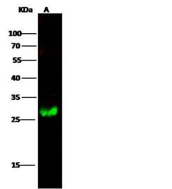 Invitrogen Calbindin Polyclonal Antibody 100 &mu;L; Unconjugated:Antibodies,