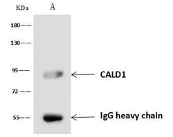 Invitrogen Caldesmon Polyclonal Antibody 100 &mu;L; Unconjugated:Antibodies,