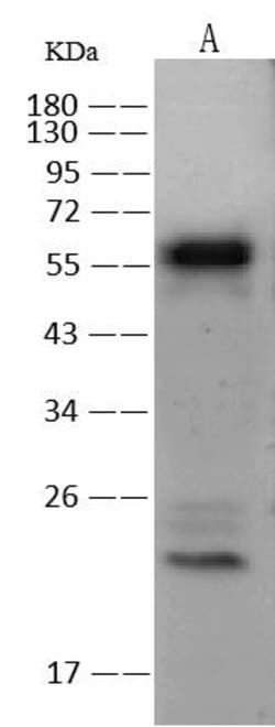 Invitrogen CaMKIV Polyclonal Antibody 100 &mu;L; Unconjugated:Antibodies,