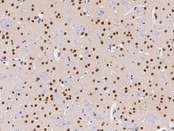 Invitrogen CaMKIV Polyclonal Antibody 100 &mu;L; Unconjugated:Antibodies,
