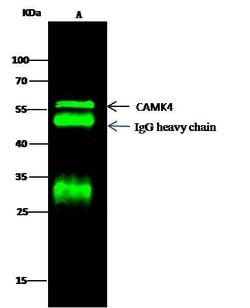 Invitrogen CaMKIV Polyclonal Antibody 100 &mu;L; Unconjugated:Antibodies,