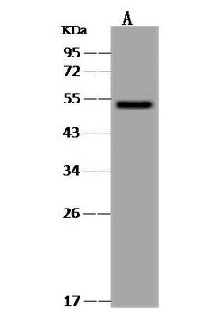 Invitrogen CaMKV Polyclonal Antibody 100 μL; Unconjugated:Antibodies,