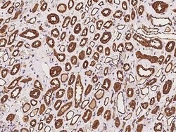 Invitrogen Calpain S1 Polyclonal Antibody 100 &mu;g; Unconjugated:Antibodies,