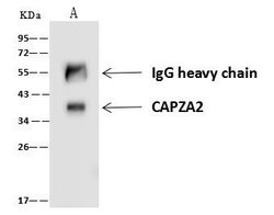 Invitrogen CAPZA2 Polyclonal Antibody 100 μL; Unconjugated:Antibodies,