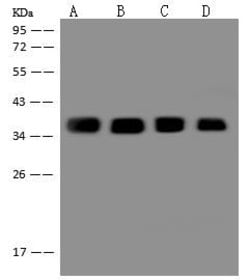 Invitrogen CAPZA2 Polyclonal Antibody 100 μL; Unconjugated:Antibodies,