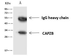 Invitrogen CAPZB Polyclonal Antibody 100 &mu;L; Unconjugated:Antibodies,
