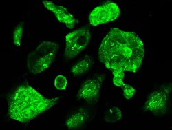Invitrogen CBF beta Polyclonal Antibody 100 &mu;L; Unconjugated:Antibodies,