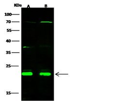 Invitrogen CBF beta Polyclonal Antibody 100 &mu;L; Unconjugated:Antibodies,