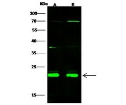 Invitrogen CBF beta Polyclonal Antibody 100 &mu;L; Unconjugated:Antibodies,
