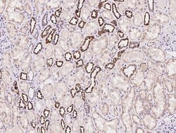 Invitrogen CBF beta Polyclonal Antibody 100 &mu;L; Unconjugated:Antibodies,