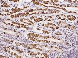 Invitrogen CBF beta Polyclonal Antibody 100 &mu;L; Unconjugated:Antibodies,