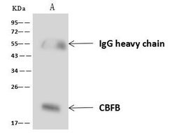Invitrogen CBF beta Polyclonal Antibody 100 &mu;L; Unconjugated:Antibodies,