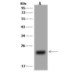 Invitrogen CBF beta Polyclonal Antibody 100 &mu;L; Unconjugated:Antibodies,