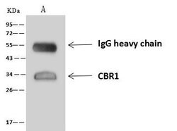 Invitrogen CBR1 Polyclonal Antibody 100 &mu;L; Unconjugated:Antibodies,