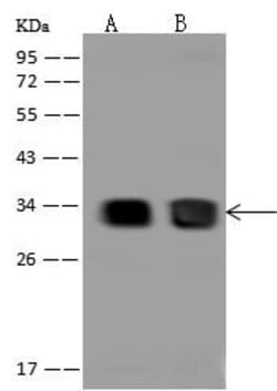 Invitrogen CBR1 Polyclonal Antibody 100 &mu;L; Unconjugated:Antibodies,