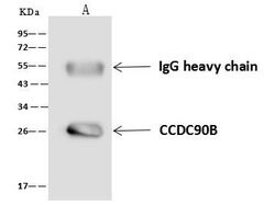 Invitrogen CCDC90B Polyclonal Antibody 100 &mu;L; Unconjugated:Antibodies,