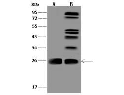 Invitrogen CCDC90B Polyclonal Antibody 100 &mu;L; Unconjugated:Antibodies,