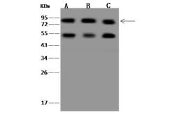 Invitrogen CD2AP Polyclonal Antibody 100 &mu;L; Unconjugated:Antikroppar