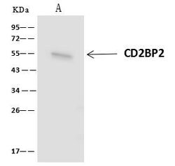 Invitrogen CD2BP2 Polyclonal Antibody 100 &mu;L; Unconjugated:Antibodies,