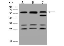 Invitrogen CD2BP2 Polyclonal Antibody 100 &mu;L; Unconjugated:Antibodies,