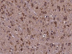 Invitrogen Cdc37 Polyclonal Antibody 100 &mu;L | Buy Online | Invitrogen&trade; | Fisher Scientific