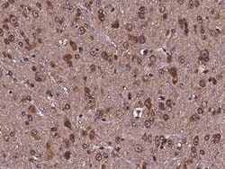 Invitrogen Cdc37 Polyclonal Antibody 100 &mu;L | Buy Online | Invitrogen&trade; | Fisher Scientific