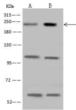 Invitrogen MRCK beta Polyclonal Antibody 100 &mu;L | Buy Online | Invitrogen&trade; | Fisher Scientific