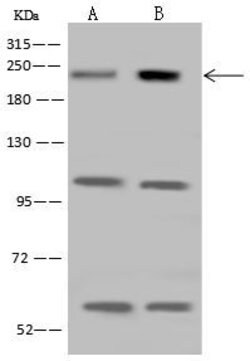 Invitrogen MRCK beta Polyclonal Antibody 100 &mu;L | Buy Online | Invitrogen&trade; | Fisher Scientific