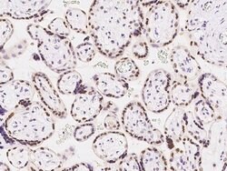 Invitrogen CDYL Polyclonal Antibody 100 &mu;L | Buy Online | Invitrogen&trade; | Fisher Scientific