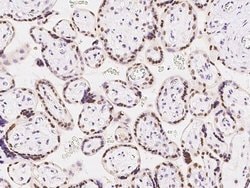 Invitrogen CDYL Polyclonal Antibody 100 &mu;L | Buy Online | Invitrogen&trade; | Fisher Scientific