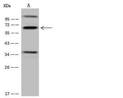 Invitrogen CDYL Polyclonal Antibody 100 &mu;L | Buy Online | Invitrogen&trade; | Fisher Scientific