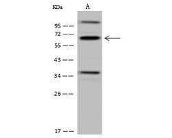 Invitrogen CDYL Polyclonal Antibody 100 &mu;L | Buy Online | Invitrogen&trade; | Fisher Scientific