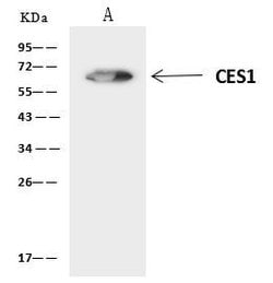 Invitrogen CES1 Polyclonal Antibody 100 &mu;L; Unconjugated:Anticuerpos
