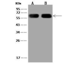 Invitrogen CES1 Polyclonal Antibody 100 &mu;L; Unconjugated:Anticuerpos