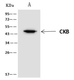 Invitrogen Creatine Kinase BB Polyclonal Antibody 100 &mu;L; Unconjugated:Antibodies,