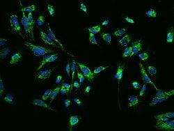 Invitrogen CLPP Polyclonal Antibody 100 &mu;L; Unconjugated:Antibodies,