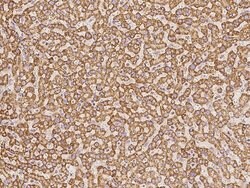 Invitrogen CLPP Polyclonal Antibody 100 &mu;L; Unconjugated:Antibodies,