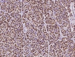 Invitrogen CLPP Polyclonal Antibody 100 &mu;L; Unconjugated:Antibodies,