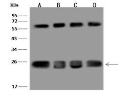 Invitrogen CLPP Polyclonal Antibody 100 &mu;L; Unconjugated:Antibodies,