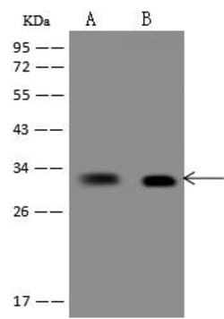 Invitrogen CNOT7 Polyclonal Antibody 100 &mu;L | Buy Online | Invitrogen&trade; | Fisher Scientific