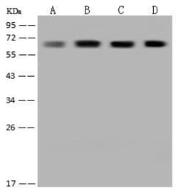Invitrogen CoA Synthase Polyclonal Antibody 100 &mu;L; Unconjugated:Antibodies,