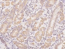 Invitrogen CSK Polyclonal Antibody 100 &mu;L; Unconjugated:Antibodies,