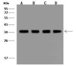 Invitrogen CYB5R3 Polyclonal Antibody 100 &mu;L; Unconjugated:Antibodies,