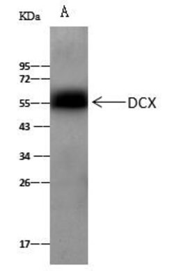 Invitrogen Doublecortin Polyclonal Antibody 100 &mu;L; Unconjugated:Antibodies,