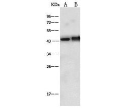 Invitrogen Doublecortin Polyclonal Antibody 100 &mu;L; Unconjugated:Antibodies,