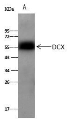 Invitrogen Doublecortin Polyclonal Antibody 100 &mu;L; Unconjugated:Antibodies,